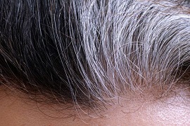 آیا استرس و فشارعصبی باعث سفید شدن موها می شود؟